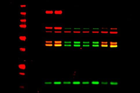 Western blot