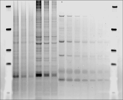 Figure 1: Pro-Q Diamond Phosphoprotein Stain