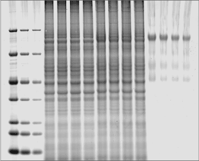 Figure 1: SYPRO Ruby