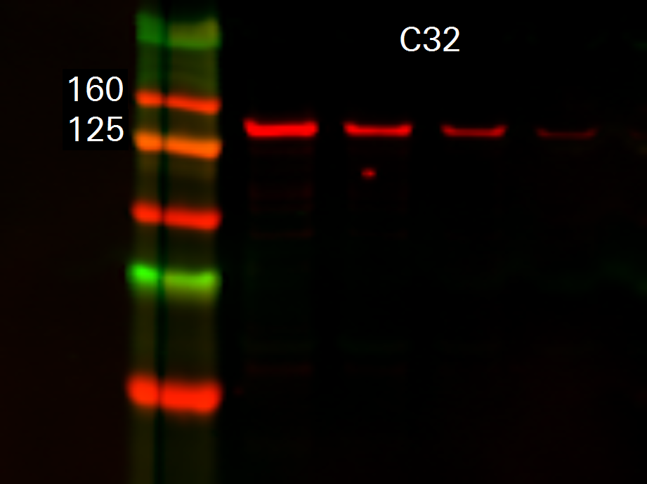 Vinculin Rabbit Monoclonal Antibody detected in C32 cells